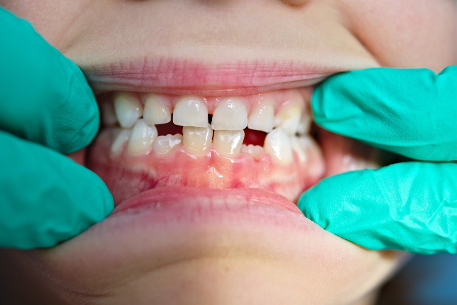 53-Dentiste-Pediatrique- Laurence-Watthe
