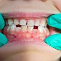 53-Dentiste-Pediatrique- Laurence-Watthe